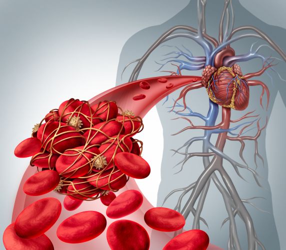 2. Impide la formación de coágulos en la sangre